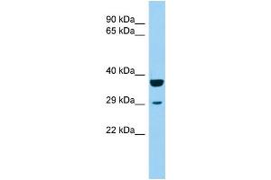 Host: Rabbit Target Name: KCTD1 Sample Type: 721_B Whole Cell lysates Antibody Dilution: 1. (KCTD1 antibody  (Middle Region))
