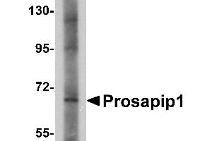 Western blot analysis of Prosapip1 in SK-N-SH cell lysate with Prosapip1 antibody at 1 µg/mL. (ProSAPiP1 antibody  (C-Term))