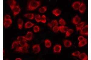 ABIN6276977 staining JK by IF/ICC. (TCP1 alpha/CCTA antibody  (C-Term))