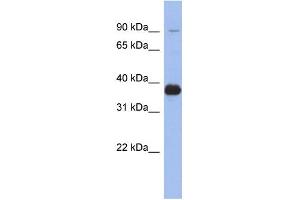 WB Suggested Anti-MPP3 Antibody Titration: 0.