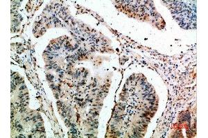 Immunohistochemistry (IHC) image for anti-C-Type Lectin Domain Family 4, Member A (CLEC4A) (AA 161-210) antibody (ABIN7180295)