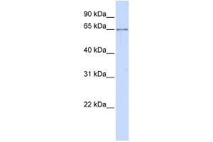 WB Suggested Anti-ALG6 Antibody Titration:  0. (ALG6 antibody  (N-Term))