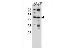 CSAD Antibody (Center) (ABIN655728 and ABIN2845175) western blot analysis in CEM,A549 cell line lysates (35 μg/lane). (CSAD antibody  (AA 197-226))