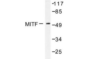 Image no. 1 for anti-Microphthalmia-Associated Transcription Factor (MITF) antibody (ABIN272035)