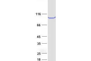 Western Blotting (WB) image for Family with Sequence Similarity 114, Member A1 (FAM114A1) protein (Myc-DYKDDDDK Tag) (ABIN2727495)