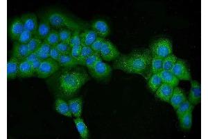 anti-ATG16 Autophagy Related 16-Like 1 (ATG16L1) (AA 66-359) antibody