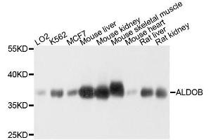 Western blot analysis of extracts of various cell lines, using ALDOB antibody.