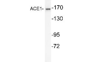 Western blot (WB) analysis of ACE1 antibody in extracts from mouse kidney cells. (Angiotensin I Converting Enzyme 1 antibody)