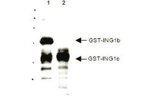 Western blot analysis using anti-p33 ING1 antibody to detect over expressed Human ING1 present in cell nuclear extracts. (ING1 antibody  (AA 285-296))