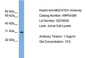 WB Suggested Anti-MGC87631  Antibody Titration: 0. (MGC87631 (Middle Region) antibody)