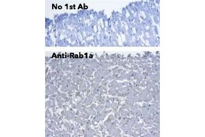 Immunohistochemistry (IHC) image for anti-RAB1A, Member RAS Oncogene Family (RAB1A) (C-Term) antibody (ABIN7272978) (RAB1A antibody  (C-Term))