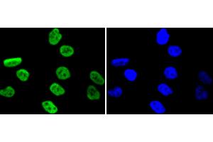 PC-3 cells were stained with MSK1 (Ser376) (11A1) Monoclonal Antibody  at [1:200] incubated overnight at 4C, followed by secondary antibody incubation, DAPI staining of the nuclei and detection. (MSK1 antibody  (pSer376))