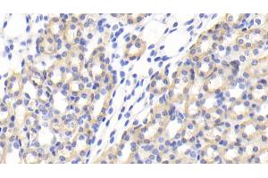Immunohistochemistry (IHC) image for anti-Interferon, alpha 7 (IFNa7) (AA 24-190) antibody (ABIN7439210)