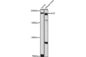 Western blot analysis of extracts of various cell lines, using  antibody (ABIN6131182, ABIN6136830, ABIN6136831 and ABIN6222940) at 1:1000 dilution. (ALS2 antibody  (AA 1-280))