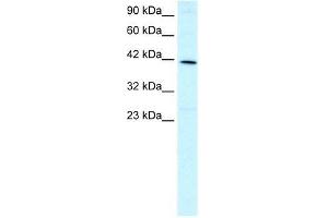 Human HepG2; WB Suggested Anti-FOXF2 Antibody Titration: 1.
