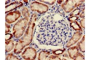 Immunohistochemistry of paraffin-embedded human kidney tissue using ABIN7162222 at dilution of 1:100 (ONECUT2 antibody  (AA 214-331))