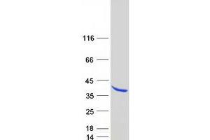 SYF2 Homolog, RNA Splicing Factor (SYF2) (Transcript Variant 1) protein (Myc-DYKDDDDK Tag)
