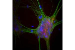 Mixed neuron-glial cultures stained with ABIN1842241, our monoclonal antibody to α-synuclein (red) and chicken polyclonal antibody to MAP2 CPCA-MAP2 (green).