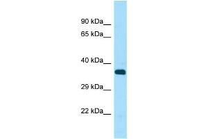 Western Blotting (WB) image for anti-serine/threonine Kinase 33 (STK33) (C-Term) antibody (ABIN2506070) (STK33 antibody  (C-Term))