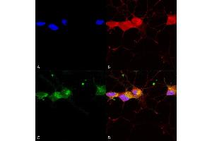 Immunocytochemistry/Immunofluorescence analysis using Mouse Anti-GluN2B/NR2B Monoclonal Antibody, Clone S59-36 (ABIN2483207). (GRIN2B antibody  (AA 20-271) (Atto 488))