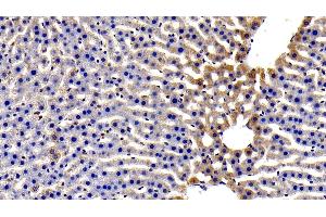 Immunohistochemistry (IHC) image for anti-Interleukin 6 Signal Transducer (Gp130, Oncostatin M Receptor) (IL6ST) (AA 26-323) antibody (ABIN7430558)