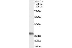 ABIN184625 (0. (BAG2 antibody  (C-Term))