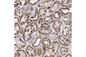 Immunohistochemical staining of human kidney with SPATA5 polyclonal antibody  shows strong cytoplasmic positivity in renal tubules.