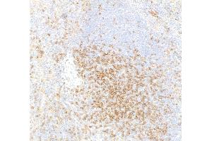 Immunohistochemistry (IHC) image for anti-CD4 (CD4) (AA 407-457) antibody (ABIN7453902) (Recombinant CD4 antibody  (AA 407-457))