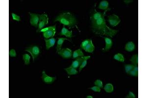 Immunofluorescence staining of MCF-7 cells with ABIN7148907 at 1:400, counter-stained with DAPI. (p21 antibody  (AA 2-164))