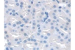 Detection of SNAP23 in Mouse Kidney Tissue using Polyclonal Antibody to Synaptosomal Associated Protein 23 kDa (SNAP23) (SNAP23 antibody  (AA 1-210))