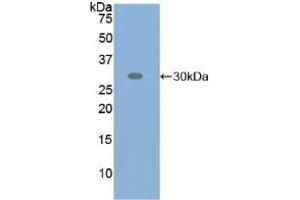 Western blot analysis of recombinant Human ATF6. (ATF6 antibody  (AA 423-646))