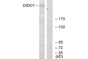 Western blot analysis of extracts from 293 cells, using DIDO1 antibody. (DIDO1 antibody)