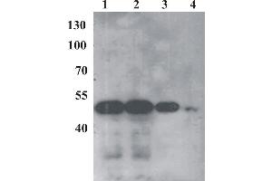 anti-Bovine Papilloma Virus 1 E2 (BPV-1 E2) (AA 250-280) antibody