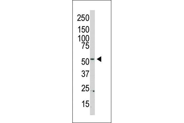 PI4K2B antibody  (N-Term)