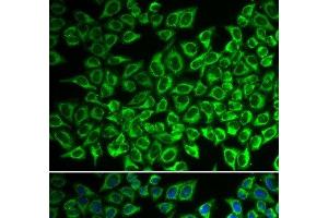 Immunofluorescence analysis of A549 cells using IL12RB1 Polyclonal Antibody (IL12RB1 antibody)