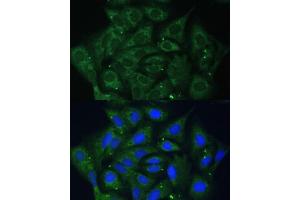 Immunofluorescence analysis of U-2 OS cells using IGF2BP2/IMP2 antibody (ABIN6131799, ABIN6142242, ABIN6142244 and ABIN6218878) at dilution of 1:100. (IGF2BP2 antibody  (AA 330-599))