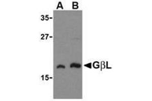 Western blot analysis of GbL in human brain cell lysate with AP30359PU-N GbL antibody at (A) 1 and (B) 2 μg/ml. (GBL antibody)