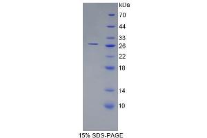Image no. 1 for ADP-Ribosylation Factor-Like 15 (ARL15) (AA 1-204) protein (His tag) (ABIN6237897) (ARL15 Protein (AA 1-204) (His tag))