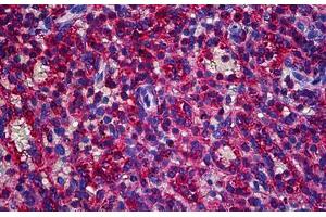 Human Spleen: Formalin-Fixed, Paraffin-Embedded (FFPE) (CAPZB antibody  (AA 192-272))