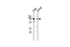 Western blot analysis of lysates from Hela, Jurkat cell line (from left to right), using Mouse Pak3 Antibody (N-term) (ABIN657852 and ABIN2846813). (PAK3 antibody  (N-Term))