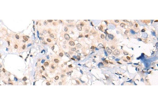 VPS51 antibody