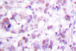 Image no. 1 for anti-V-Myb Myeloblastosis Viral Oncogene Homolog (Avian) (MYB) antibody (ABIN272041) (MYB antibody)