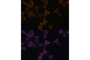 Immunofluorescence analysis of NIH-3T3 cells using AMPKβ1 Polyclonal Antibody (ABIN6129906, ABIN6146174, ABIN6146176 and ABIN7101403) at dilution of 1:100 (40x lens). (PRKAB1 antibody  (AA 1-80))