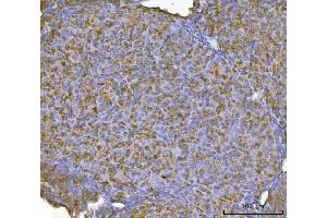 IHC analysis of RBP1 using anti-RBP1 antibody (ABIN7599586). (RBP1 antibody  (AA 10-135))