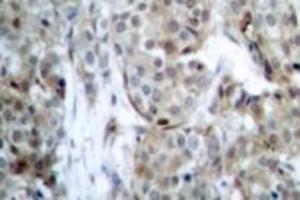 Image no. 2 for anti-BCL2-Associated Agonist of Cell Death (BAD) (pSer112), (pSer75) antibody (ABIN318169) (BAD antibody  (pSer75, pSer112))