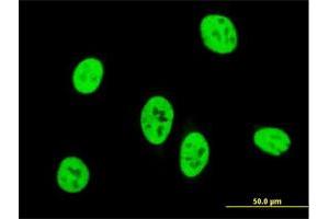 Immunofluorescence (IF) image for anti-SMAD, Mothers Against DPP Homolog 3 (SMAD3) (AA 147-270) antibody (ABIN517628)
