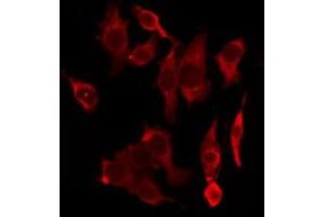 ABIN6277418 staining HeLa by IF/ICC. (P2RY4 antibody  (C-Term))