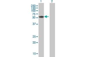 Western Blot analysis of ZNF276 expression in transfected 293T cell line by ZNF276 MaxPab polyclonal antibody. (ZNF276 antibody  (AA 1-373))