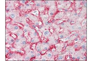 Immunohistochemistry (IHC) image for anti-Solute Carrier Family 2 (Facilitated Glucose Transporter), Member 2 (SLC2A2) antibody (ABIN400751)