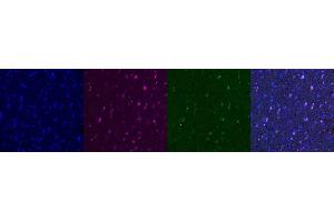 Immunohistochemistry (IHC) image for anti-Interferon gamma (IFNG) antibody (ABIN7456092) (Interferon gamma antibody)